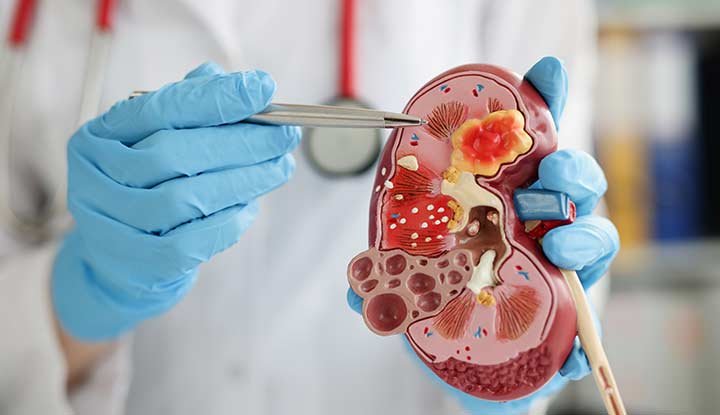 illustration of kidney | William Hospital Office Nagercoil